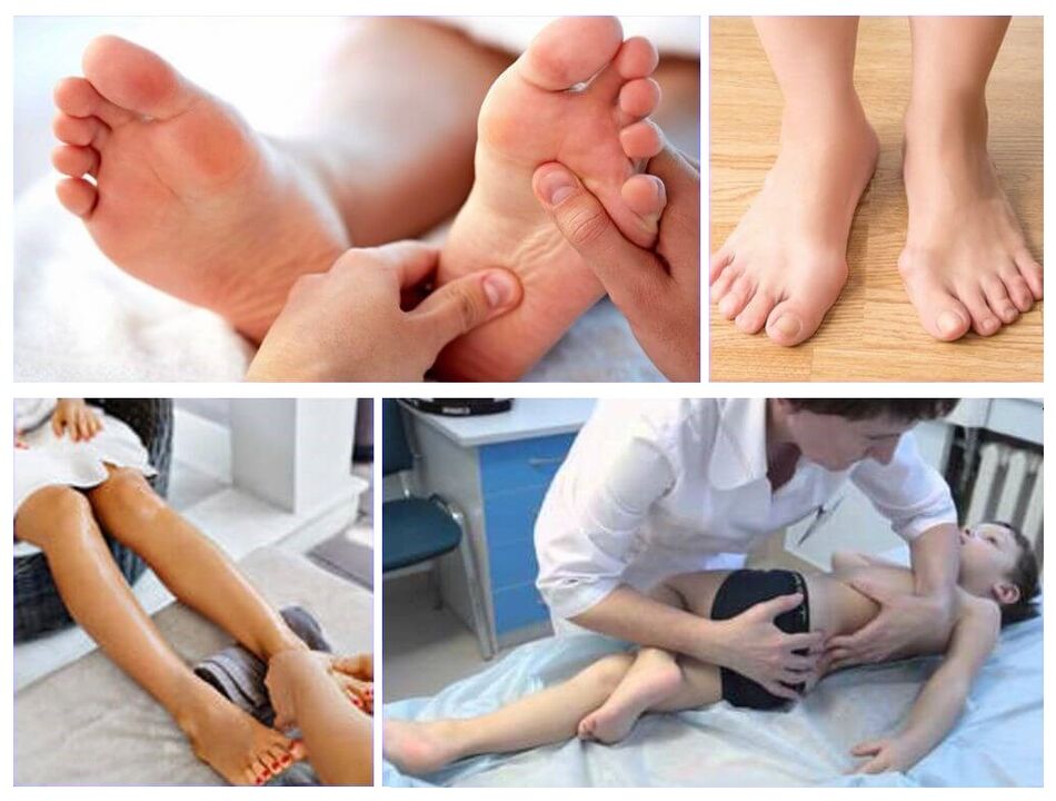 Deformación do valgus no tratamento dos nenos